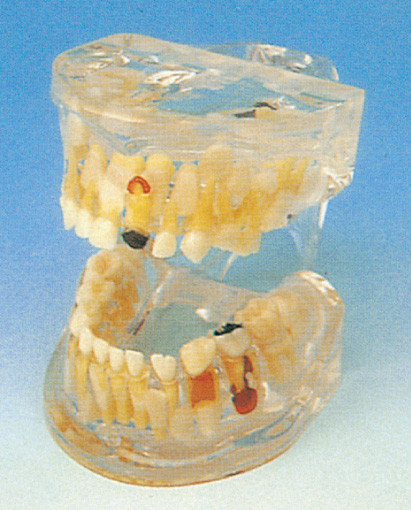 Людская модель зубов/ясная патология зубов молока моделируют для тренировки зубоврачебных школ